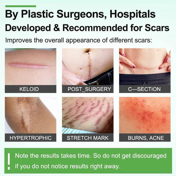 Silicone Gel Sheets – Gentle Scar Reduction Therapy