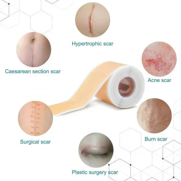 Silicone Gel Sheets – Gentle Scar Reduction Therapy