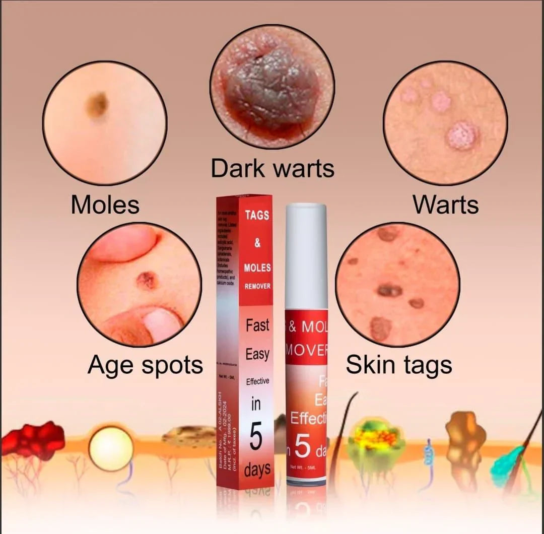AyurvaCare™ Tags & Mole Remover