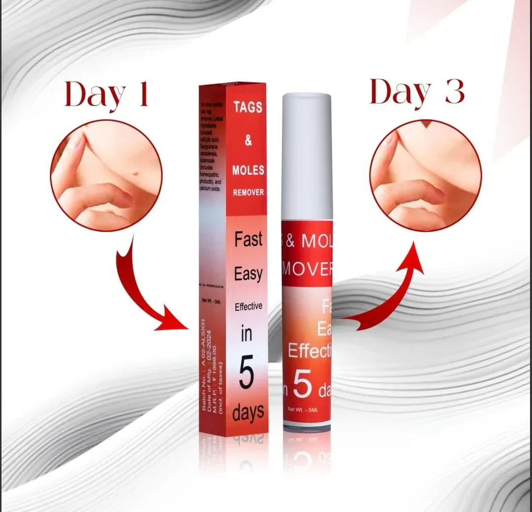 AyurvaCare™ Tags & Mole Remover