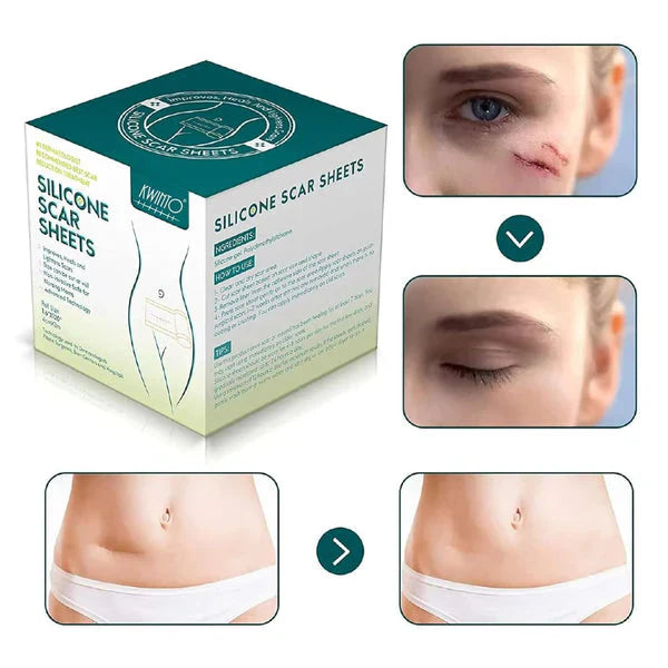 Silicone Gel Sheets – Gentle Scar Reduction Therapy