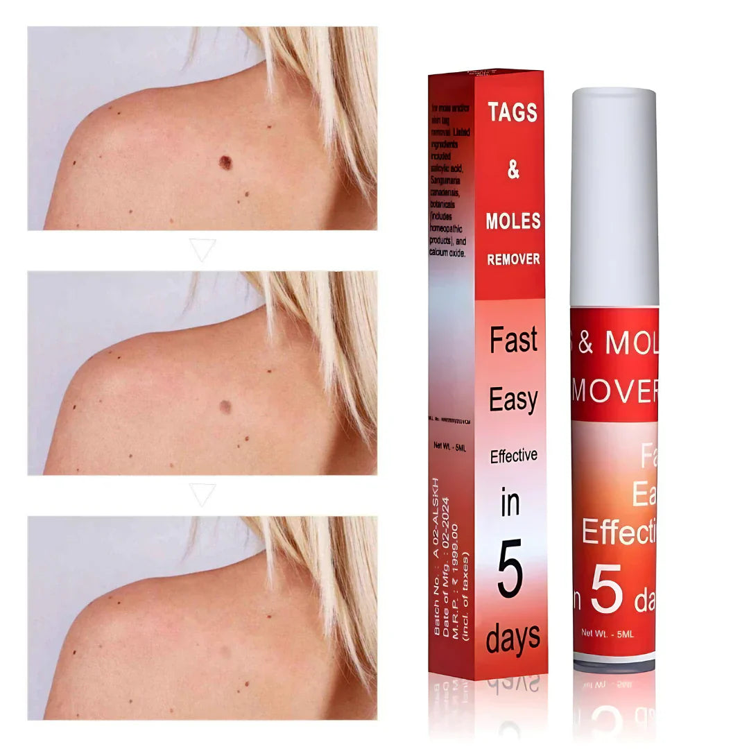 AyurvaCare™ Tags & Mole Remover